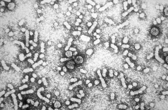 Stop Penularan Hepatitis B